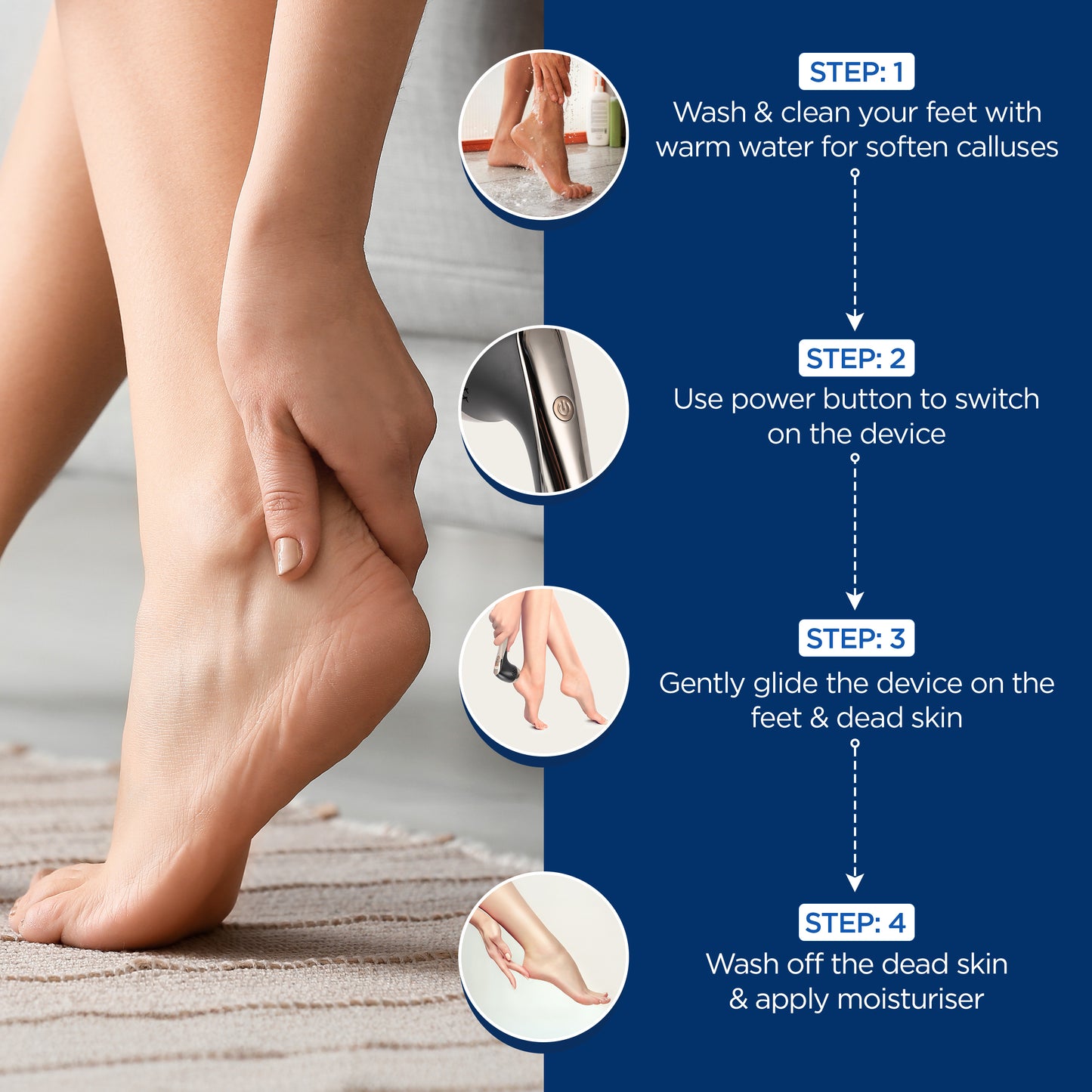 Feetish Callus Remover